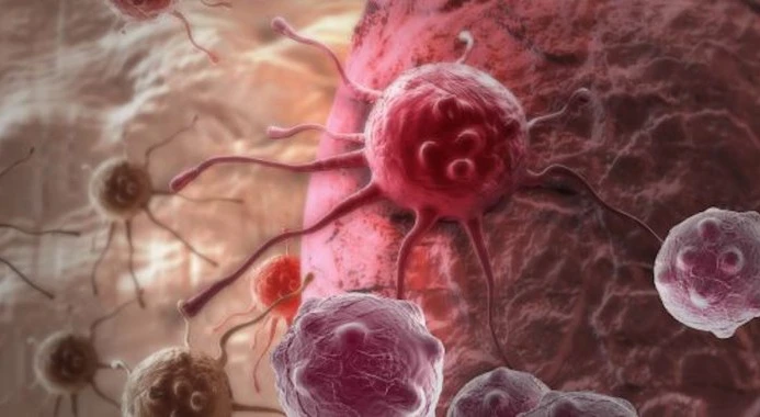 Investigadores criam dispositivo que monitoriza “em tempo real” cancro do pâncreas