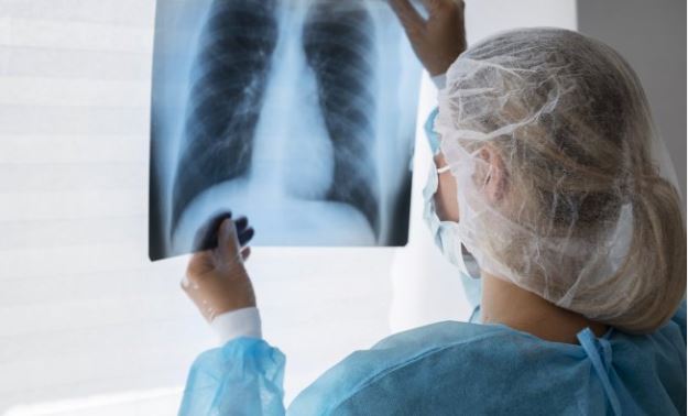 Portugal está no nível zero na luta contra o cancro do pulmão