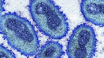 Madeira é a terceira região com mais casos do virus monkeypox