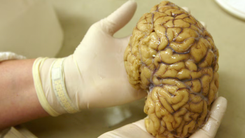 Estudo revela que o cérebro humano está a ficar maior