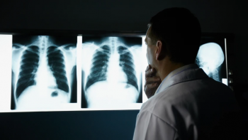 Madeira regista cerca de 100 casos de cancro do pulmão anualmente (áudio)