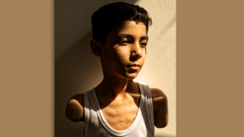 Imagem de Guerra de Gaza na fotografia do ano do World Press Photo com menino palestiniano mutilado