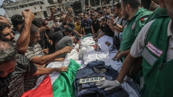 Imagem de Mais cinco mortes por desnutrição em Gaza, incluindo uma criança de 4 anos