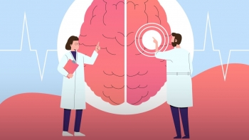 Imagem de Região regista entre 600 a 700 casos de AVC por ano (áudio)