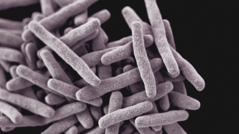 Imagem de Casos de tuberculose aumentam na Madeira, mas continuam sem causar alarme (áudio)