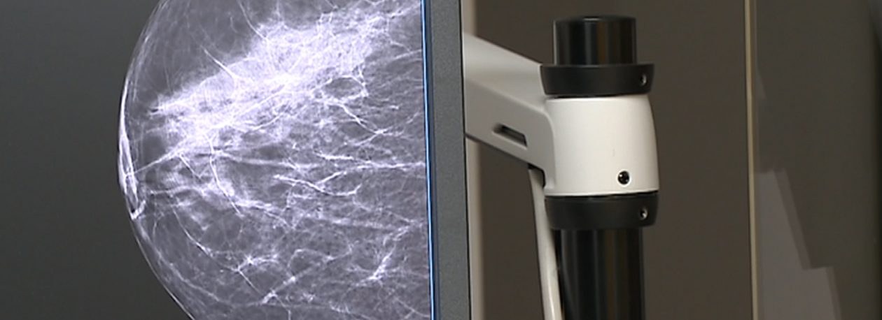 Imagem de Menopausa potencia o desenvolvimento de cancro na mama (vídeo)