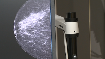 Imagem de Menopausa potencia o desenvolvimento de cancro na mama (vídeo)